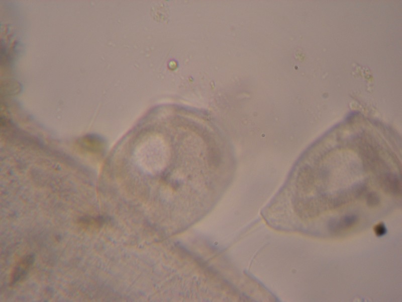 Macronucleo Vorticella