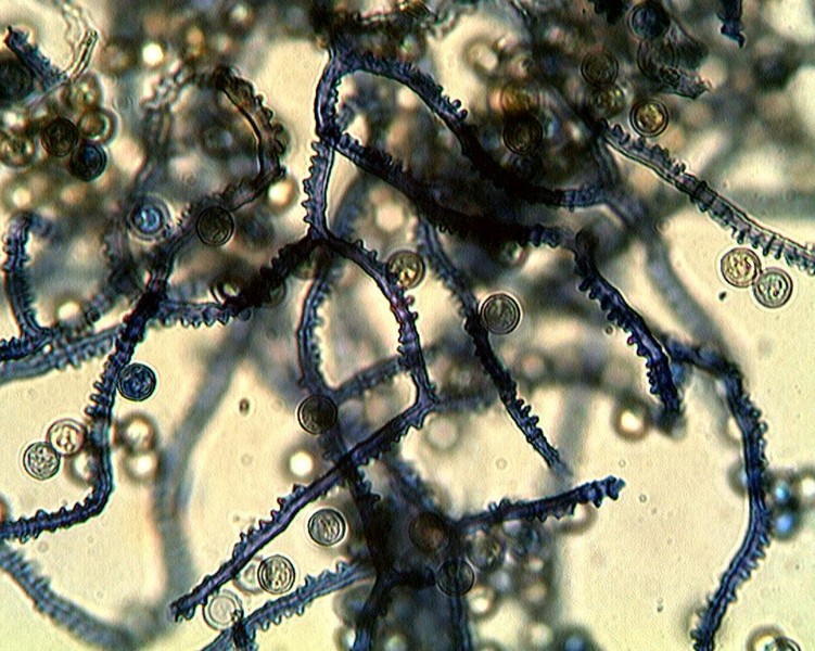 Arcyria denudata??
