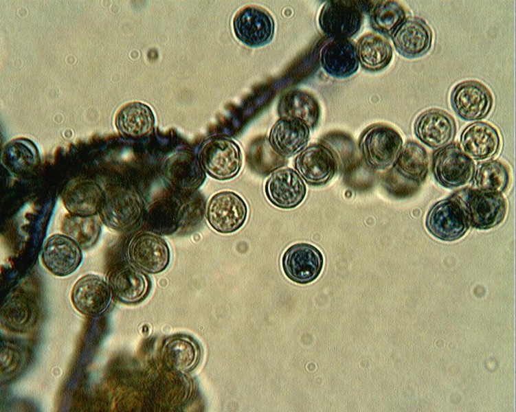Arcyria denudata??
