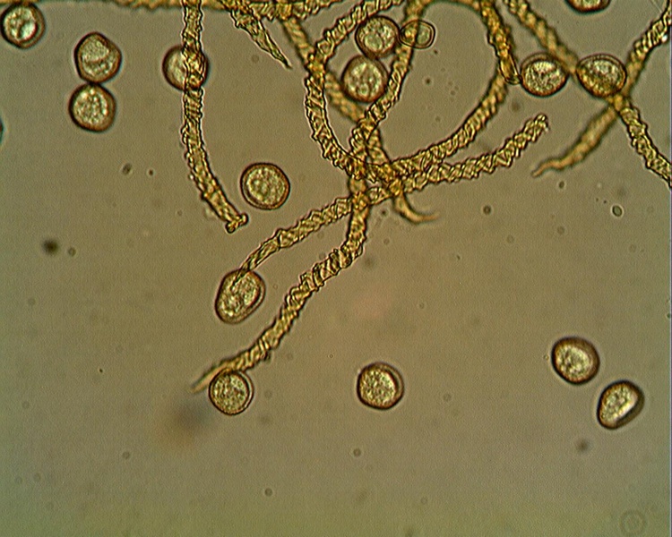 Trichia lutescens??