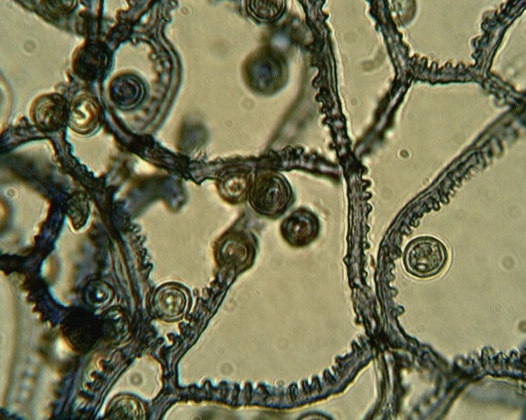 Arcyria denudata??
