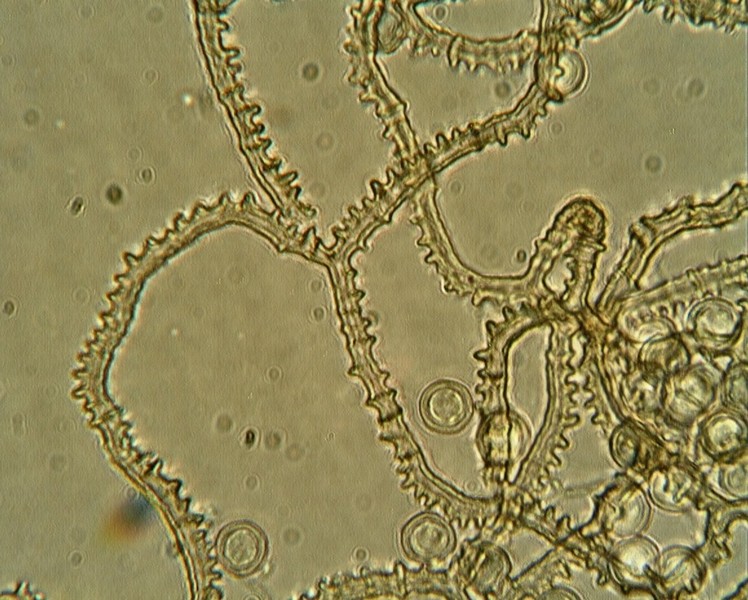 Arcyria denudata??