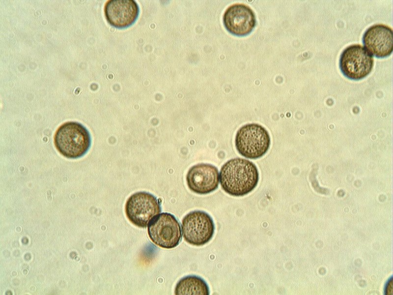 Diderma spumarioides