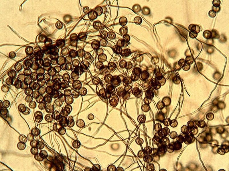 Diderma spumarioides