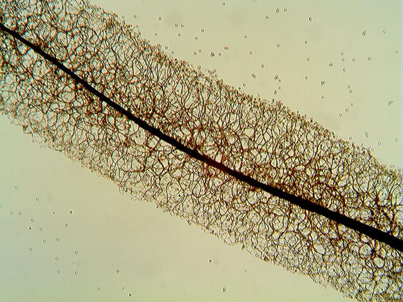 Stemonitopsis hyperopta