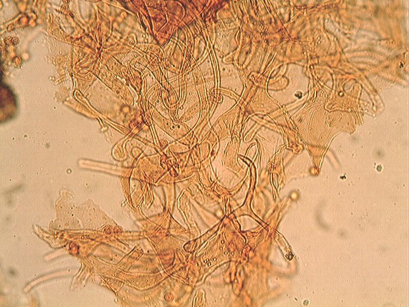 Lycogala exiguum