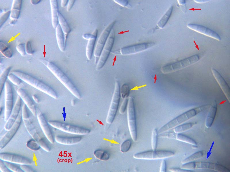 Funghi ?  Batteri ?  Bacherozzi ?