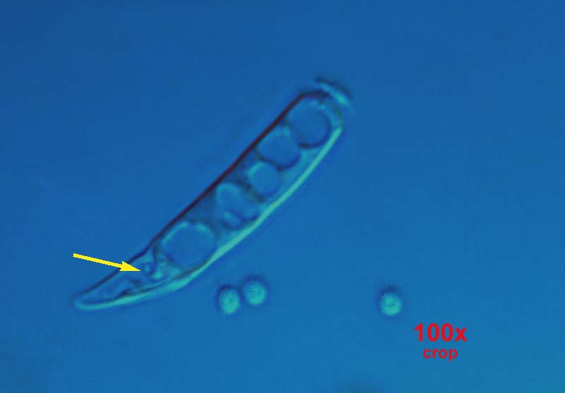 Funghi ?  Batteri ?  Bacherozzi ?