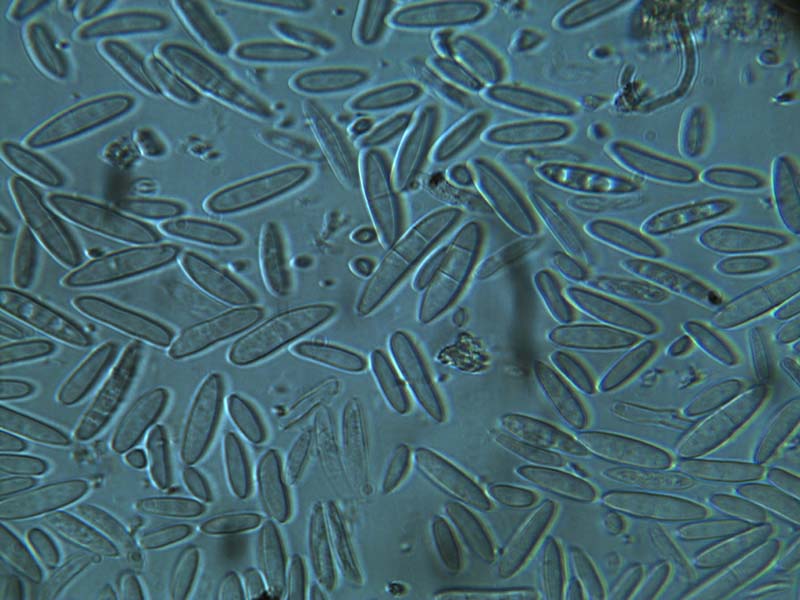 Funghi ?  Batteri ?  Bacherozzi ?