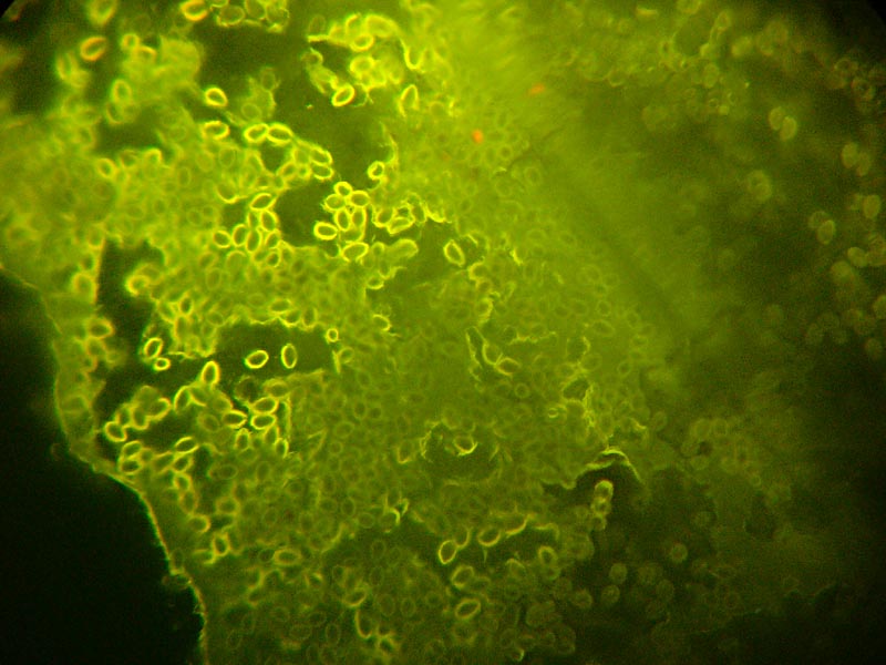 Clorofilla fluorescente