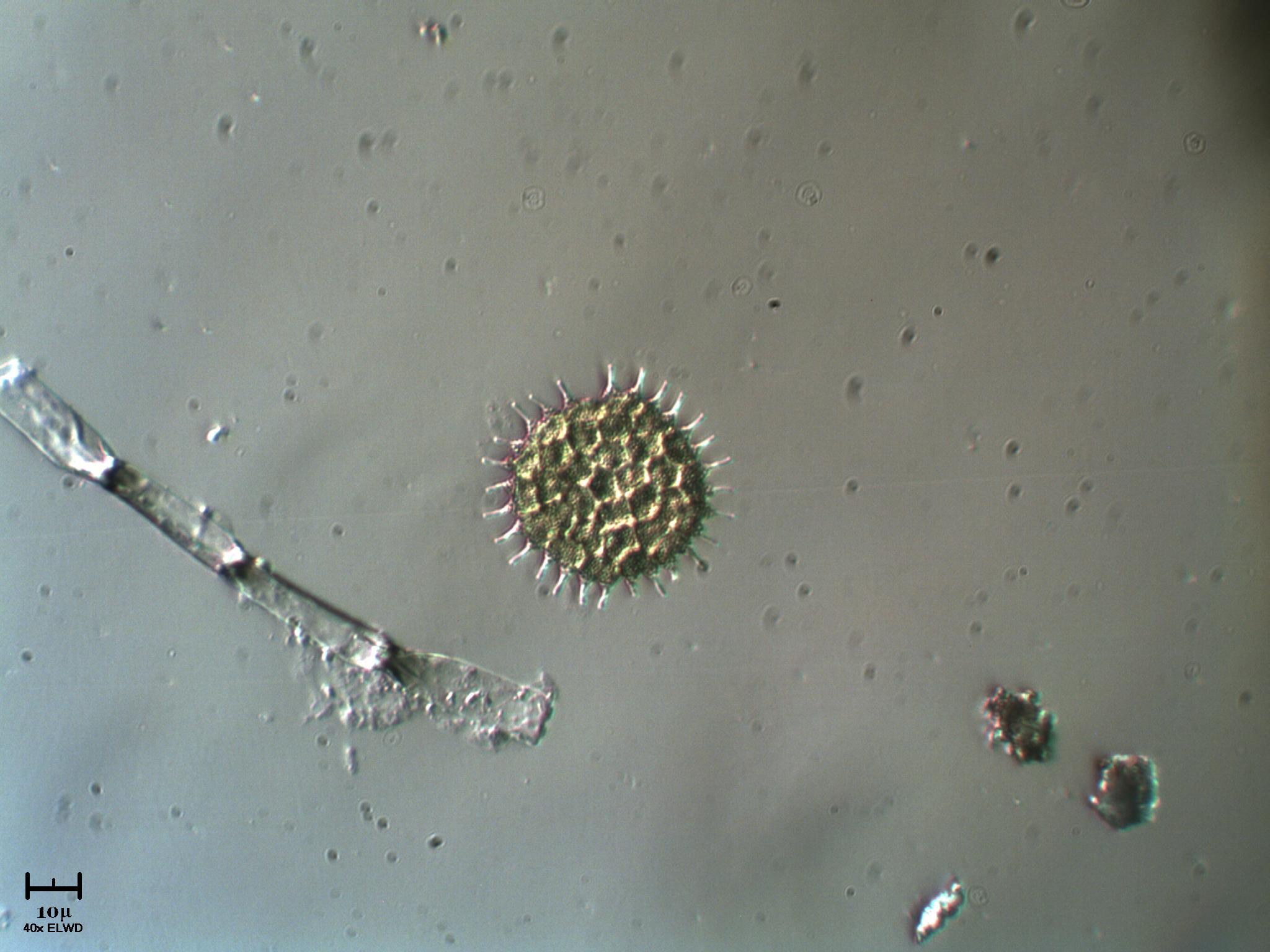 Pediastrum