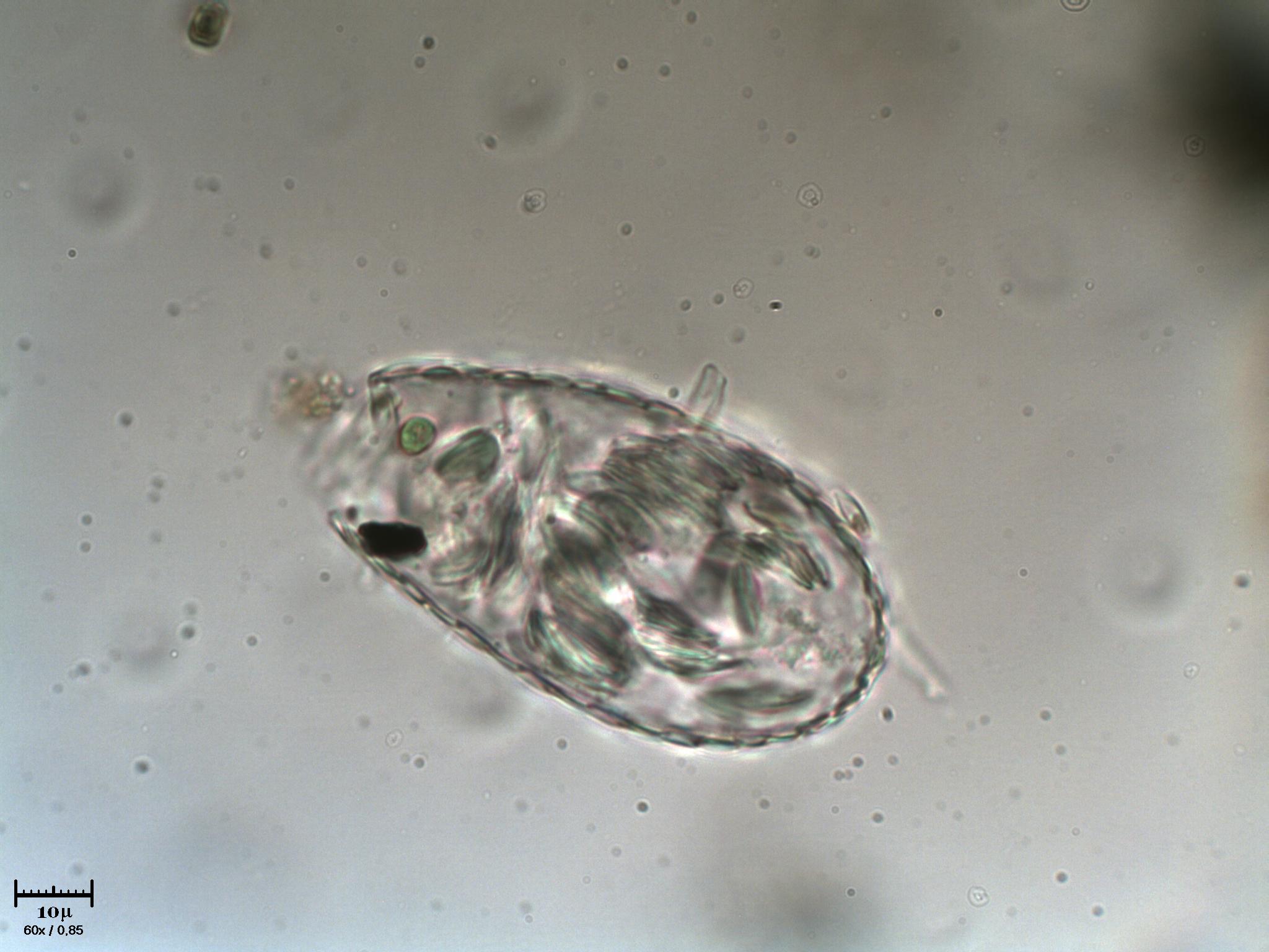 Euglypha sp.