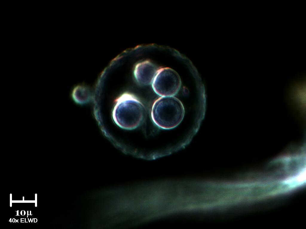 Strana ampolla