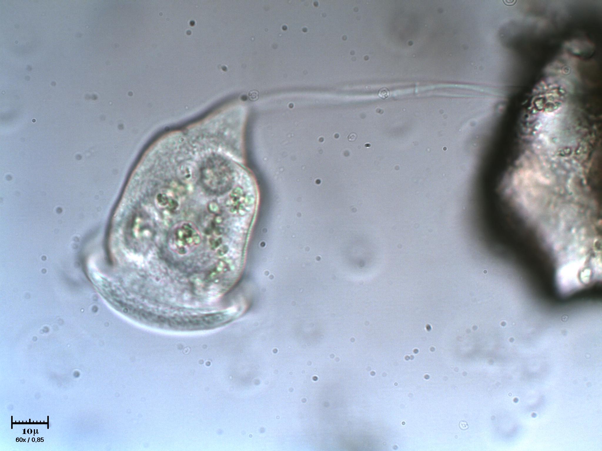 Giramento di Vorticella