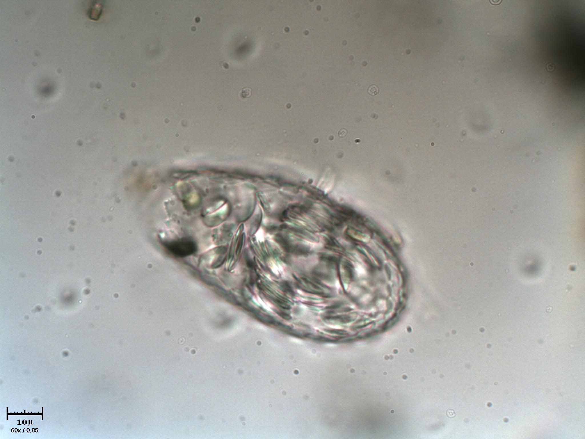 Euglypha sp.