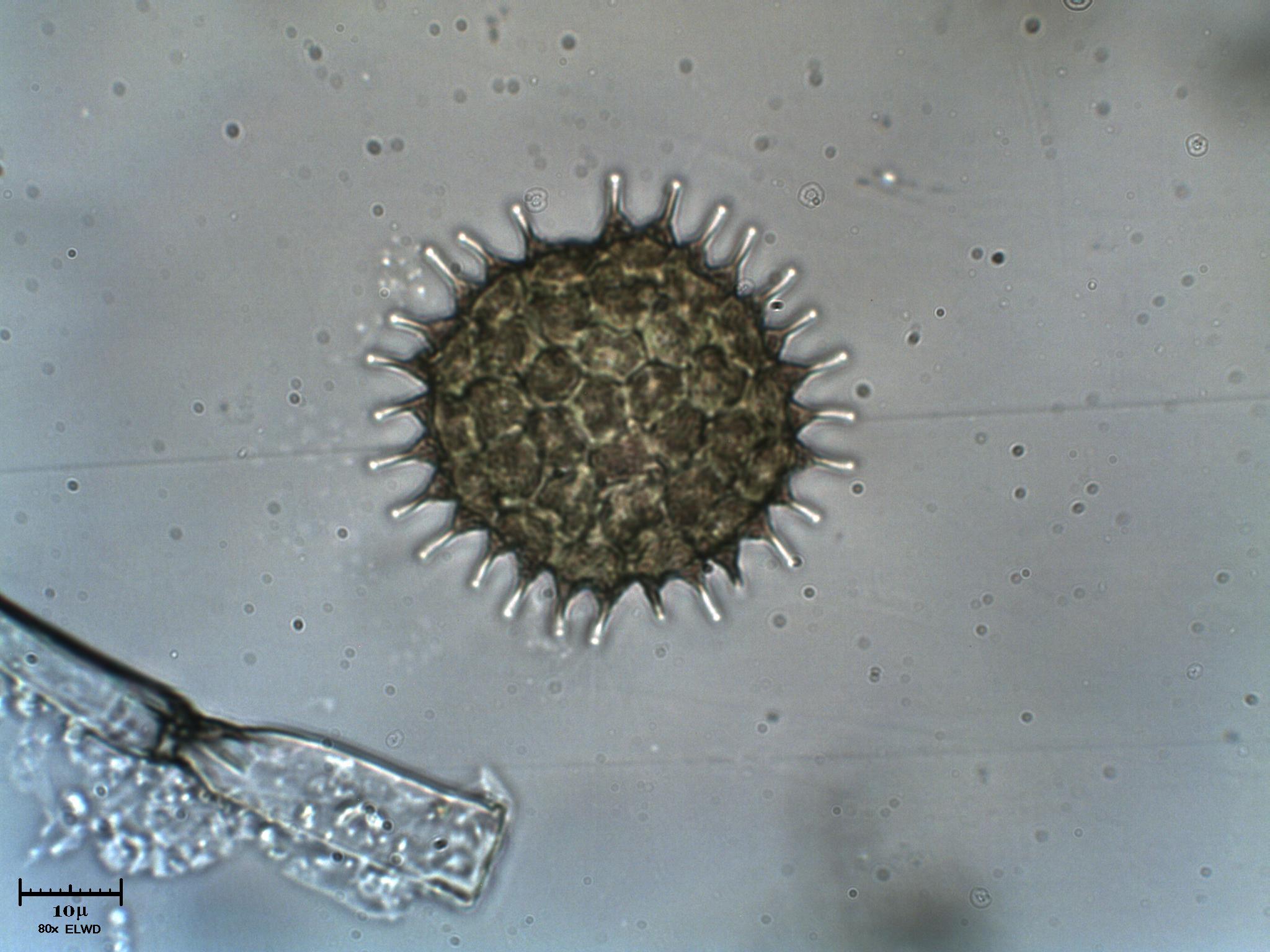 Pediastrum