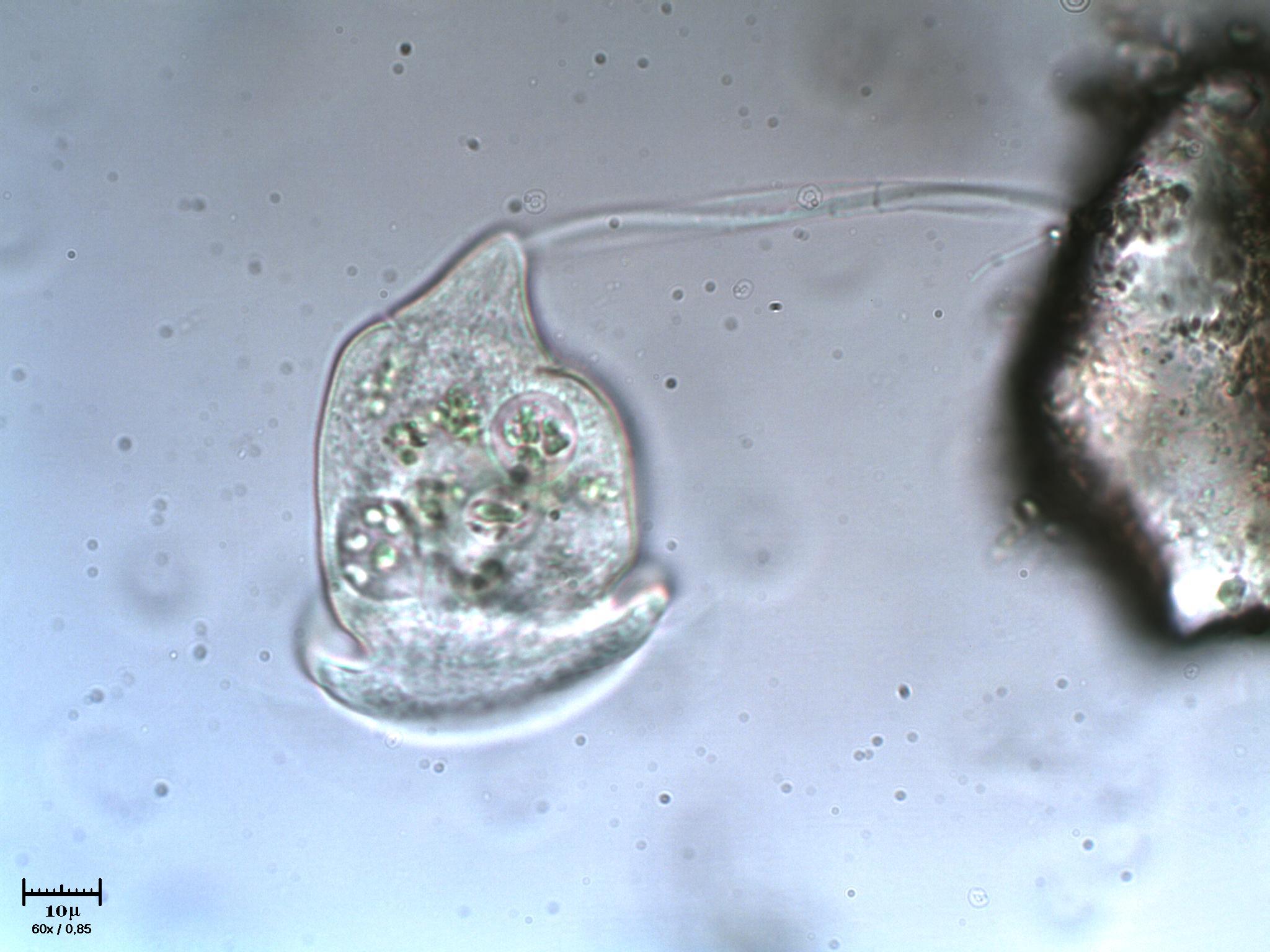 Giramento di Vorticella