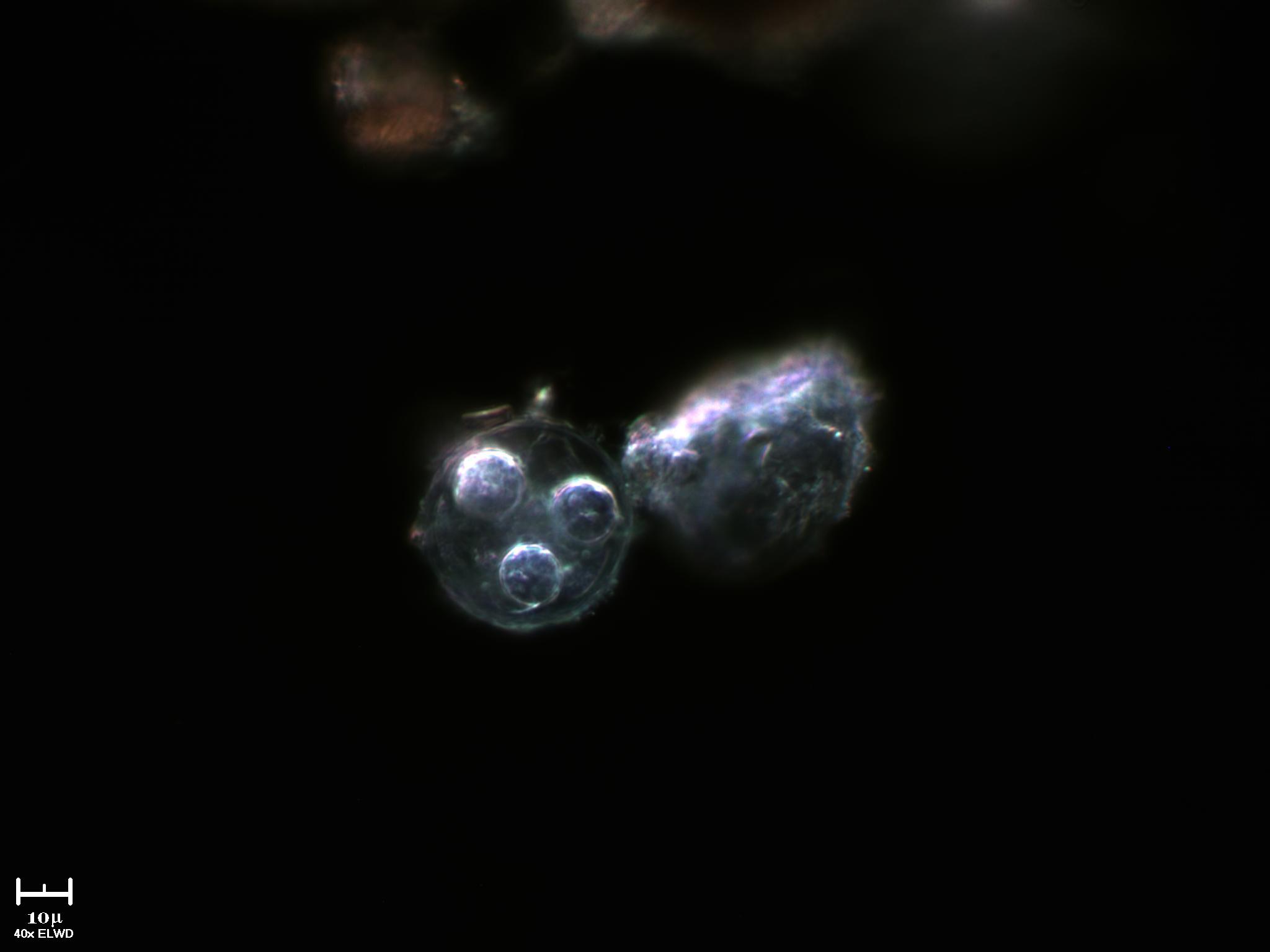 Strana ampolla