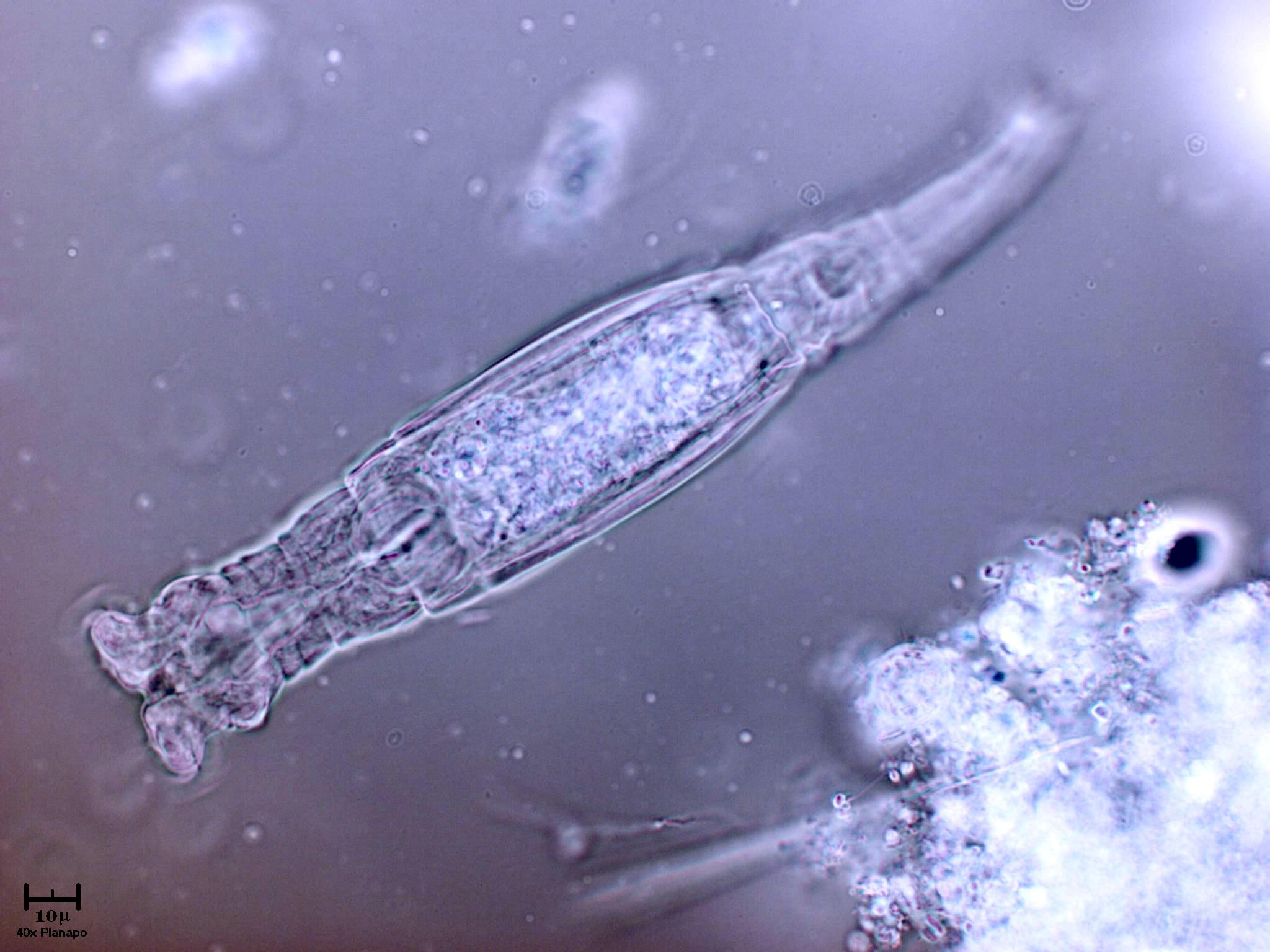 Ogni tanto qualche rotifero sta un p� fermo...