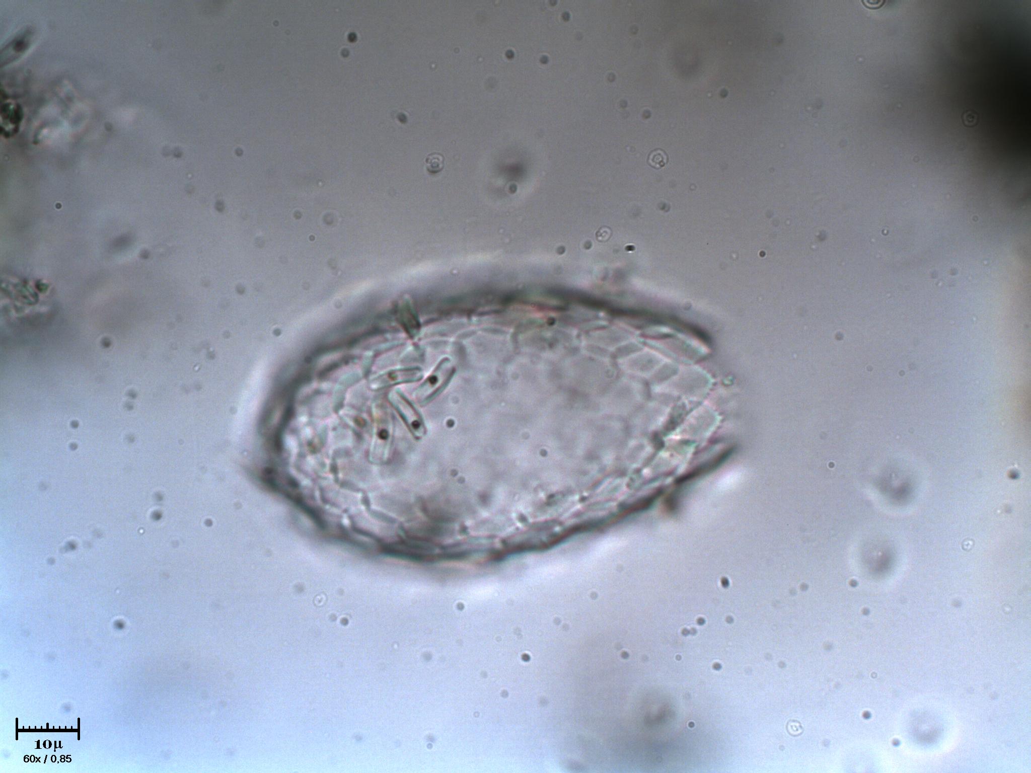 Euglypha sp.