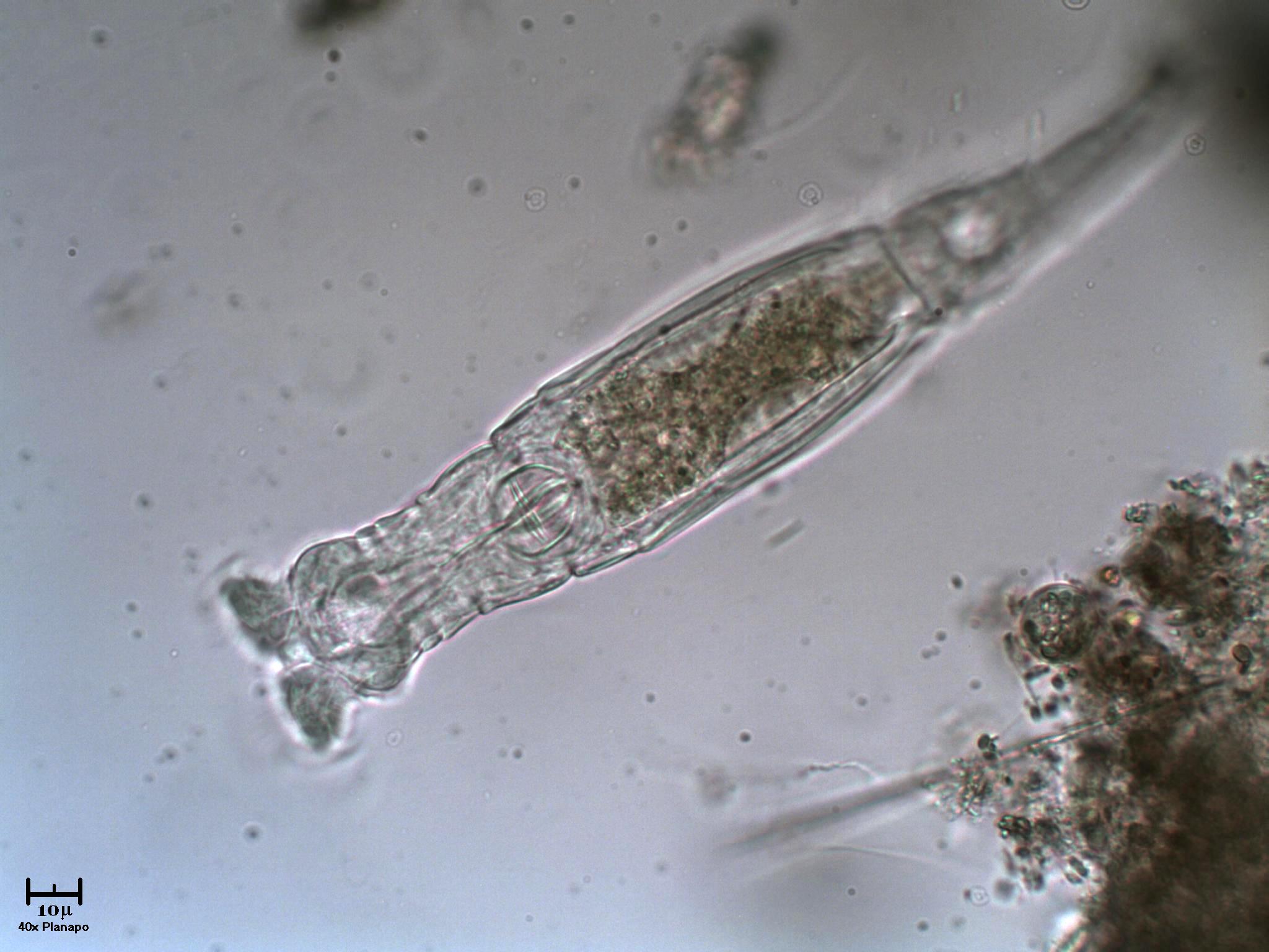 Ogni tanto qualche rotifero sta un p� fermo...