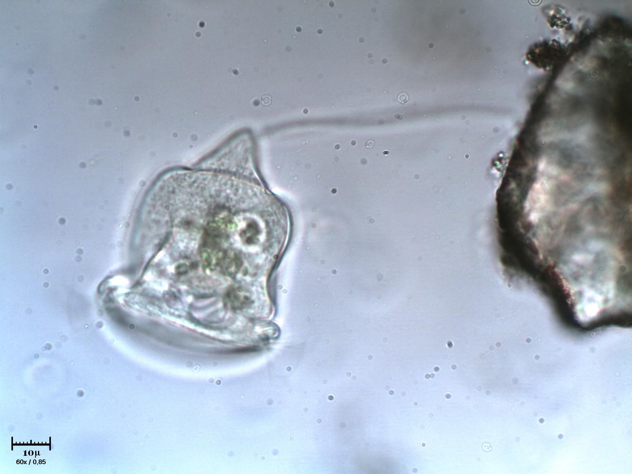Giramento di Vorticella