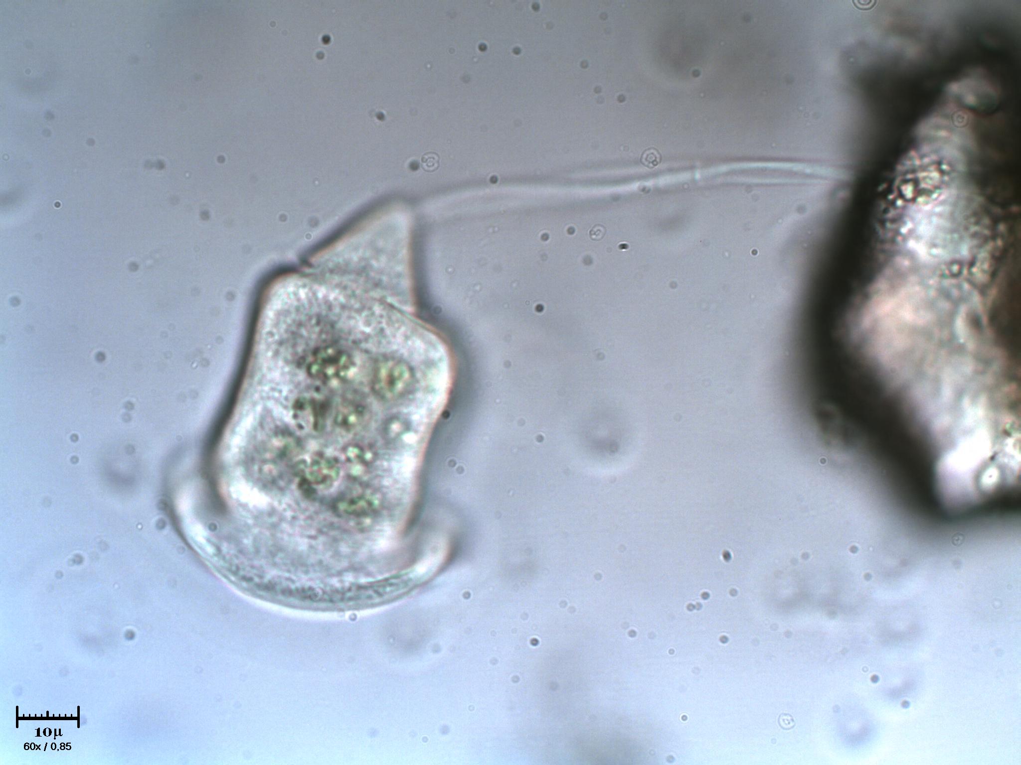 Giramento di Vorticella