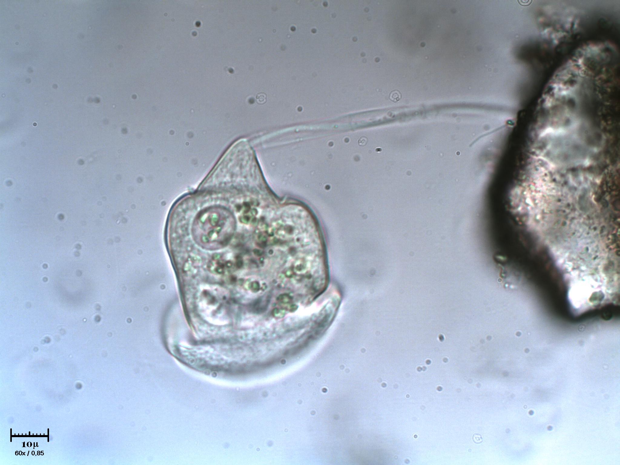 Giramento di Vorticella