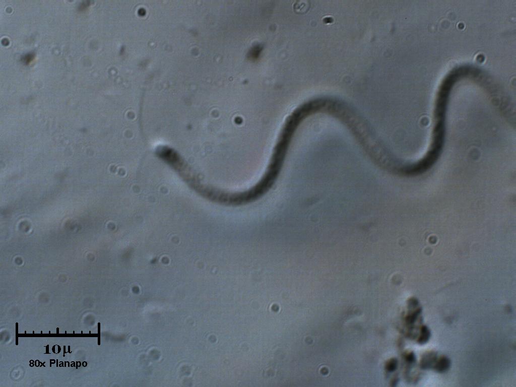 Spirillum