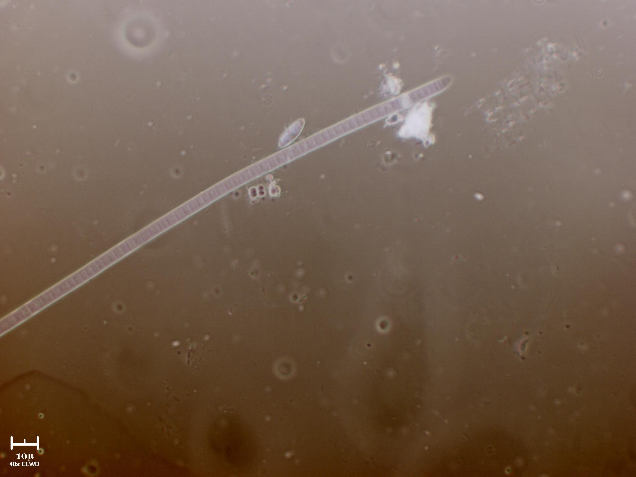 Cianobatterio e altre meraviglie