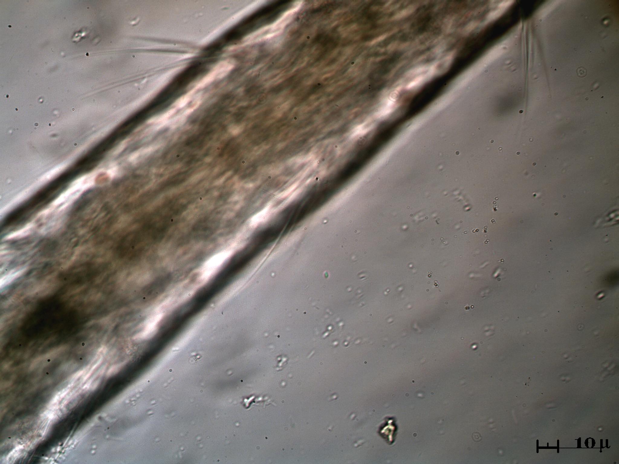 Aeolosoma Hemprichi