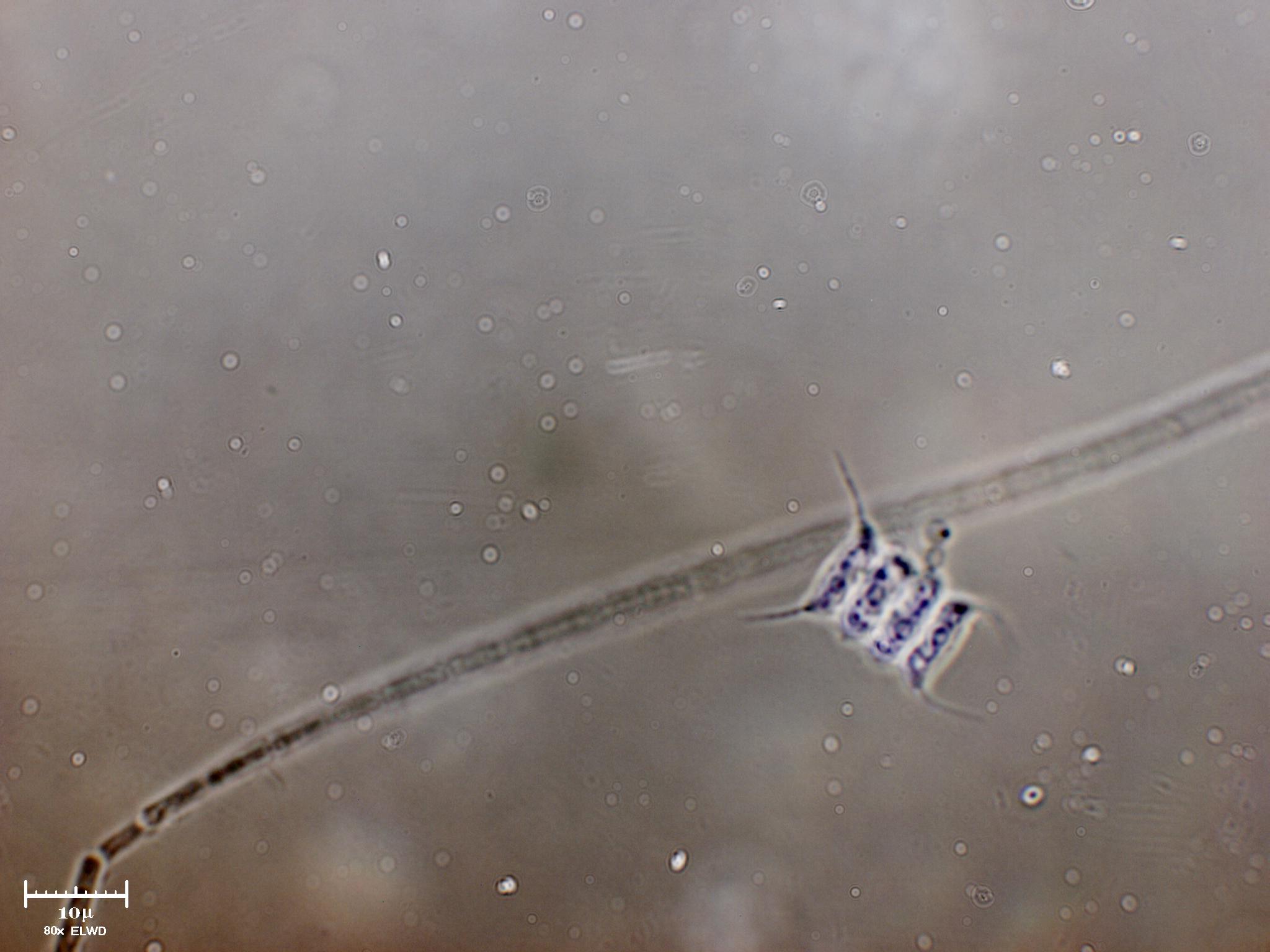 Scenedesmus sp.