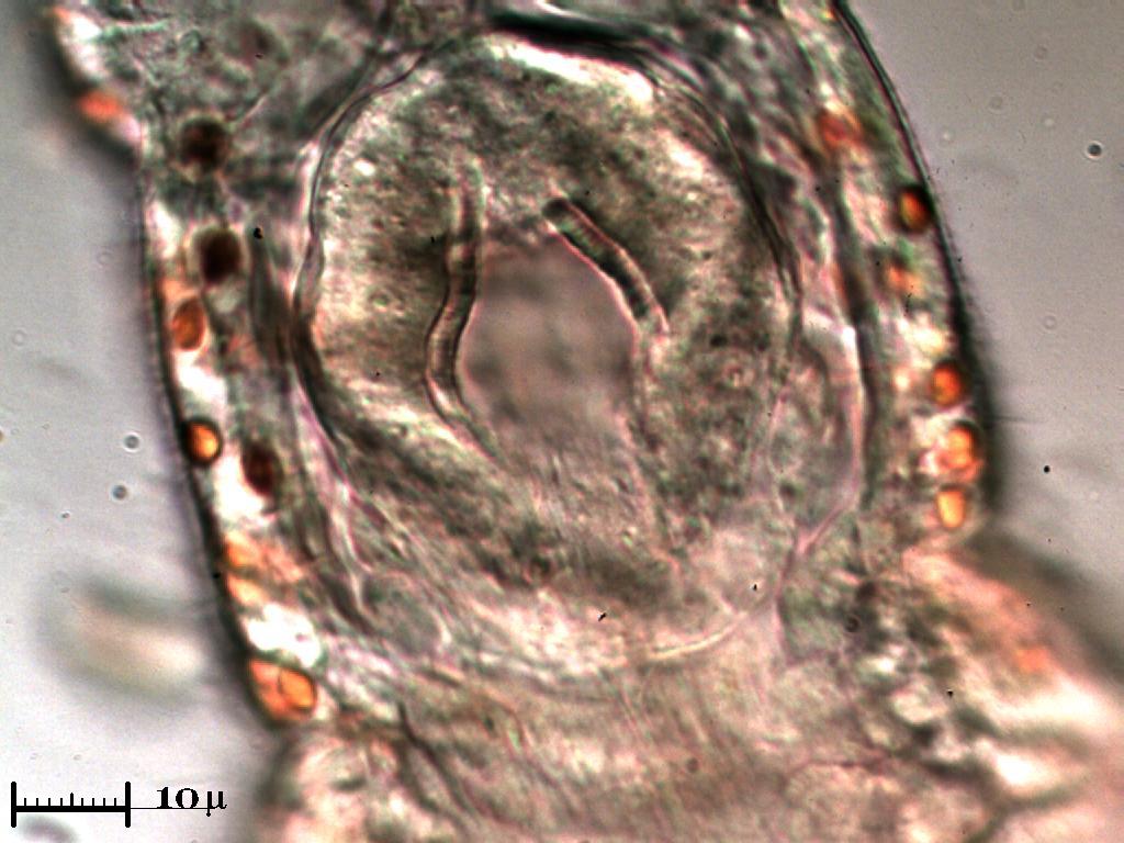 Aeolosoma Hemprichi