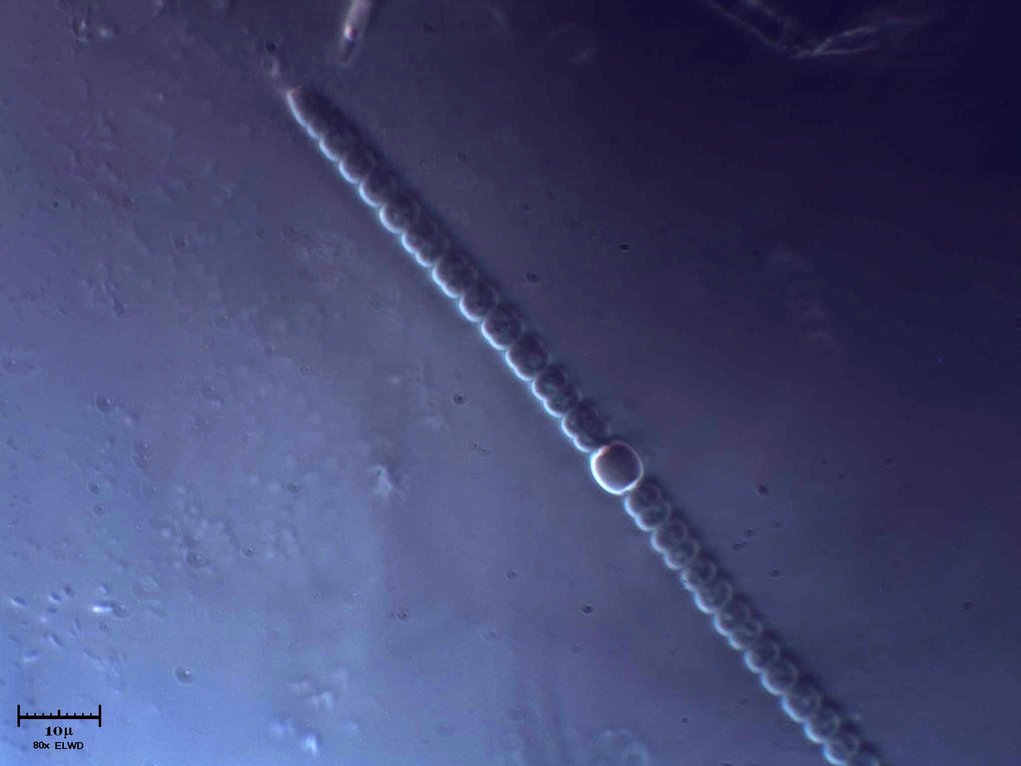 Anabaena