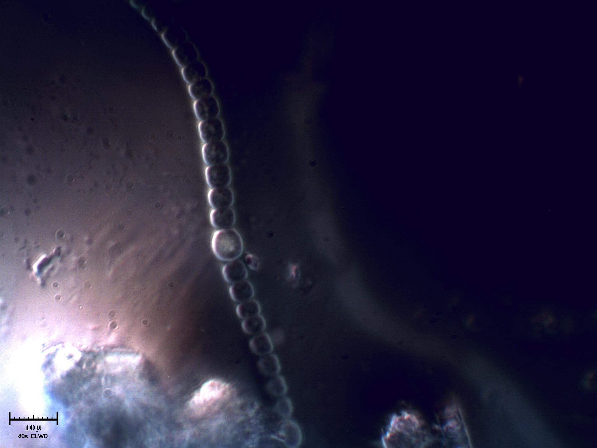 Anabaena