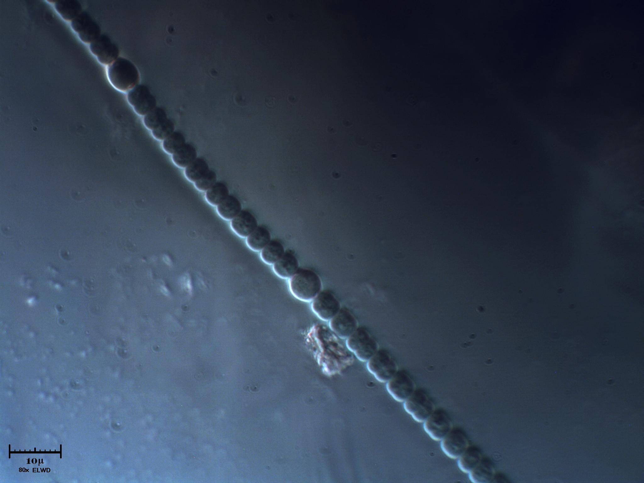 Anabaena