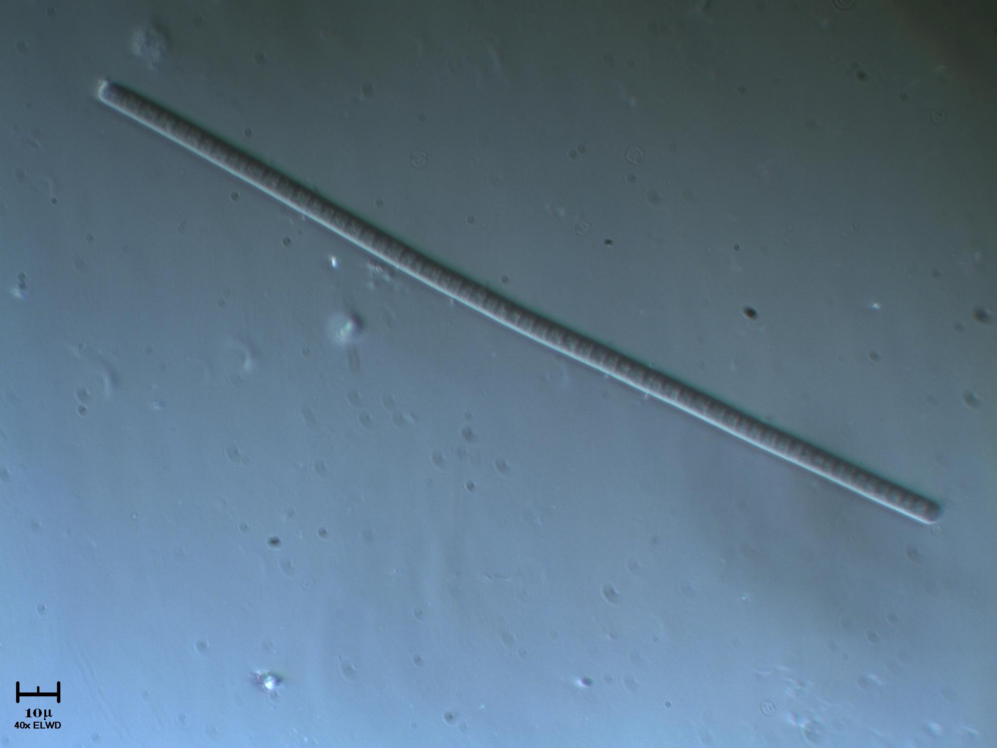 Cianobatterio e altre meraviglie