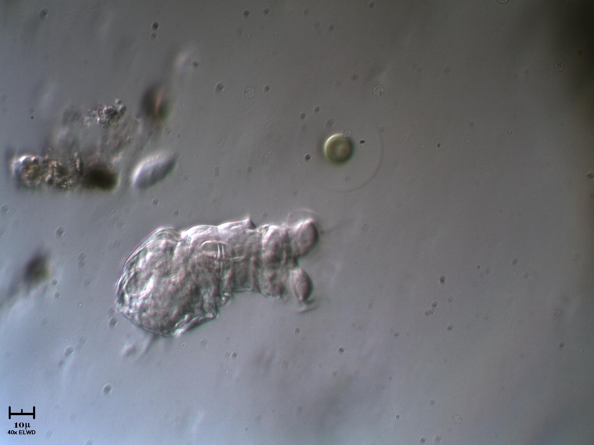 Rotaria rotatoria & Vitreochlamis