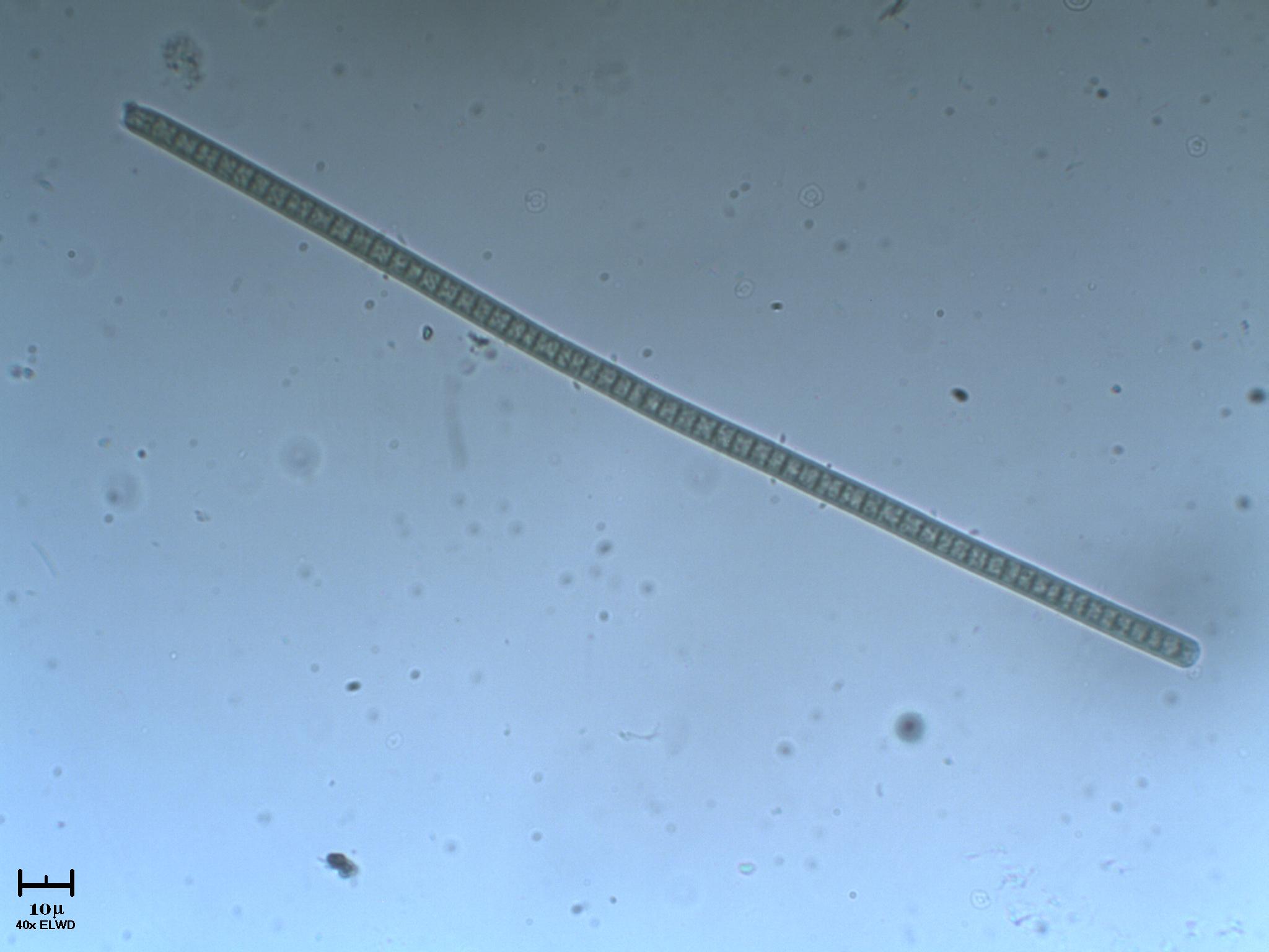 Cianobatterio e altre meraviglie