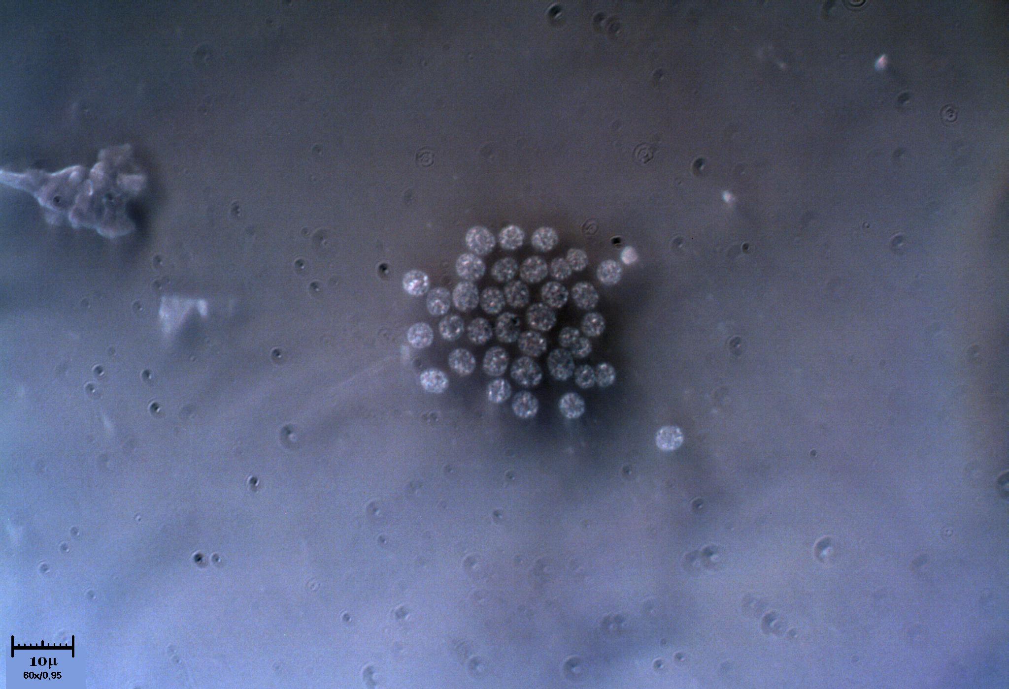 Microcistis?