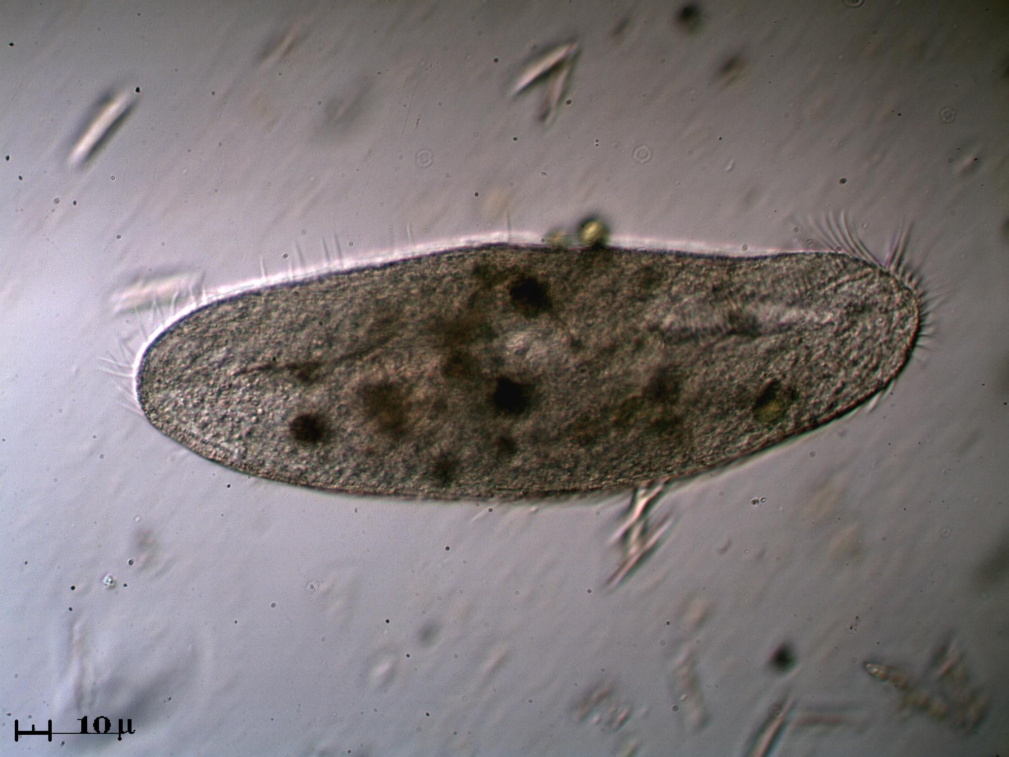 Hypotrichia - video - aiuto identificazione