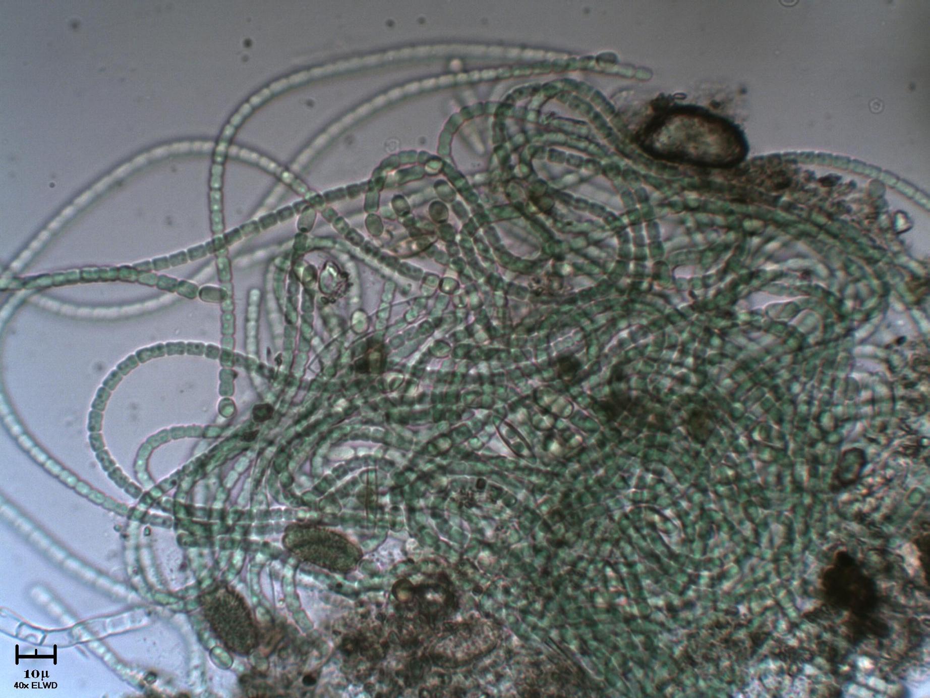 Anabaena