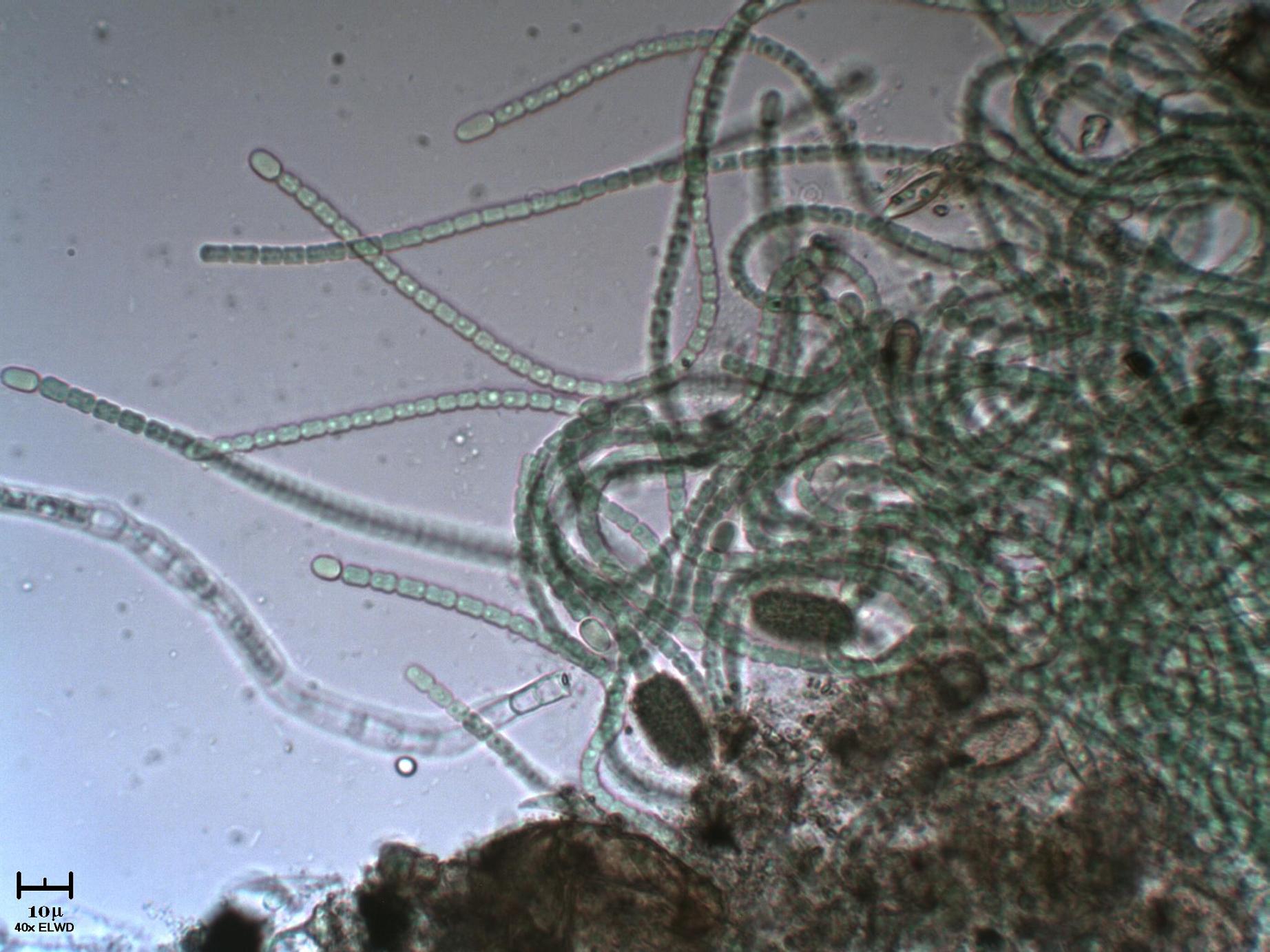 Anabaena