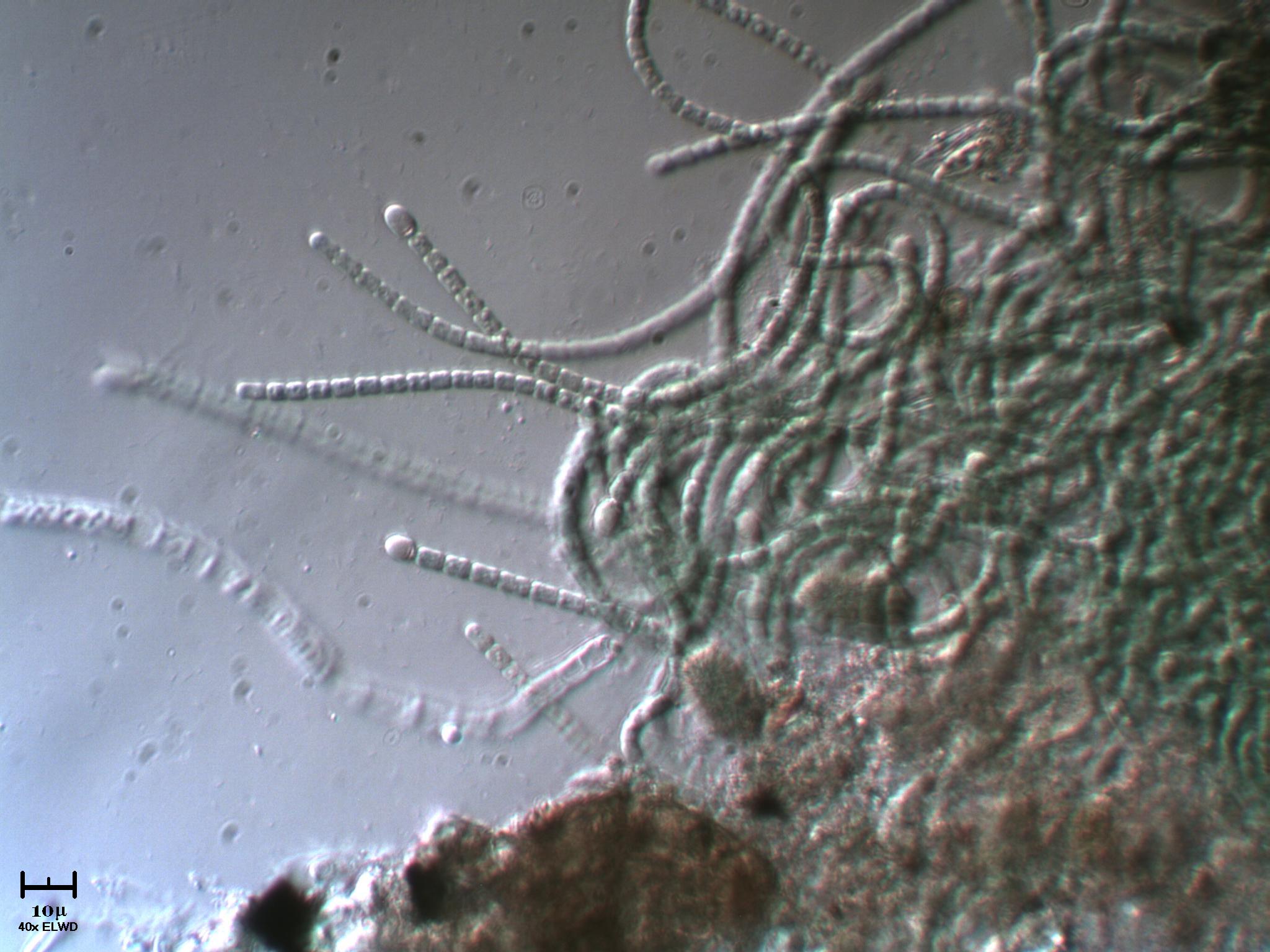 Anabaena