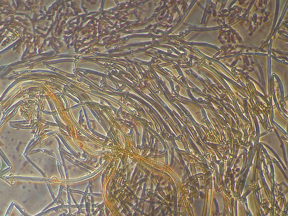 Scytinostromella olivaceoalba?(Leptosporomyces fuscostratus)