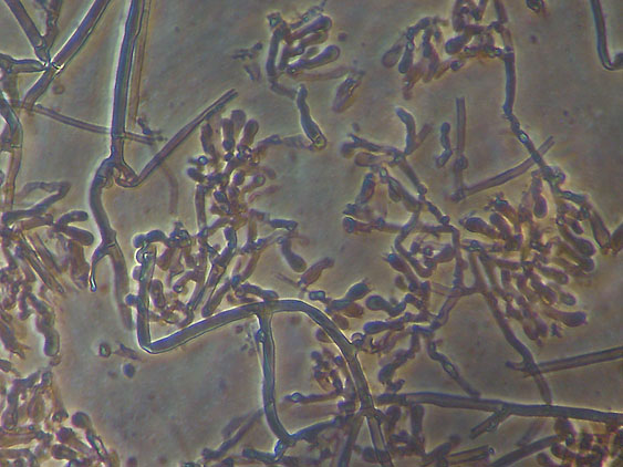 Scytinostromella olivaceoalba?(Leptosporomyces fuscostratus)