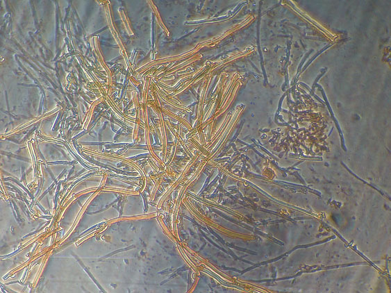 Scytinostromella olivaceoalba?(Leptosporomyces fuscostratus)