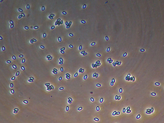 Scytinostromella olivaceoalba?(Leptosporomyces fuscostratus)