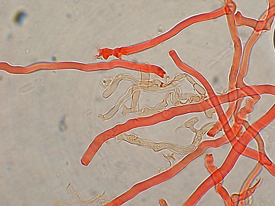 Raccolta da identificare (Heterobasidion abietinum)