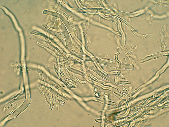 Antrodia xantha
